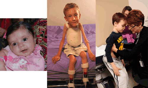 Left: Infant with SMA Type I characteristics; Center: Boy with turtleshell & AFOs; Right: medical provider checks a boys hips while another adult watches