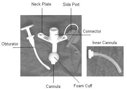 Labeled image of a tracheostomy tube: Obturator, neck plate, site port, cannula, connector, inner cannula, foam cuff